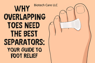 Why Overlapping Toes Need the Best Separators: Your Guide to Foot Relief